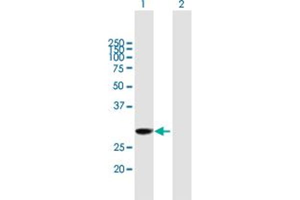 EXOSC3 Antikörper  (AA 1-275)