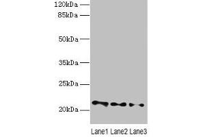 Western blot All lanes: VPS25 antibody at 3 μg/mL Lane 1: Mouse kidney tissue Lane 2: HL60 whole cell lysate Lane 3: THP-1 whole cell lysate Secondary Goat polyclonal to rabbit IgG at 1/10000 dilution Predicted band size: 21 kDa Observed band size: 21 kDa (VPS25 Antikörper  (AA 1-176))