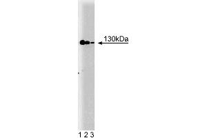 Western blot analysis of iNOS/NOS Type II on a cell lysate from mouse macrophages (RAW 264. (NOS2 Antikörper  (AA 961-1144))