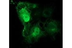 Anti-TUBB4 mouse monoclonal antibody (ABIN2454637) immunofluorescent staining of COS7 cells transiently transfected by pCMV6-ENTRY TUBB4 (RC203945). (TUBB4 Antikörper)