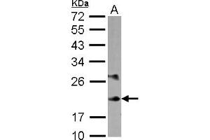 Western Blotting (WB) image for anti-Myosin, Light Chain 6B, Alkali, Smooth Muscle and Non-Muscle (MYL6B) (AA 1-208) antibody (ABIN1499618) (MYL6B Antikörper  (AA 1-208))