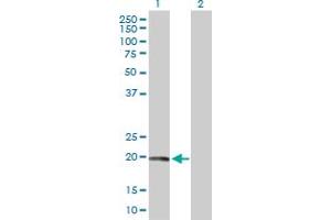 Western Blot analysis of CAV1 expression in transfected 293T cell line by CAV1 MaxPab polyclonal antibody. (Caveolin-1 Antikörper  (AA 1-178))