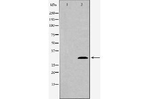 Western blot analysis of extracts of mouse spleen tissue , using ATG5 antibody. (ATG5 Antikörper  (C-Term))