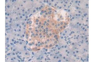 Immunohistochemistry (IHC) image for anti-Vascular Endothelial Growth Factor A (VEGFA) (AA 28-147) antibody (ABIN7429445)