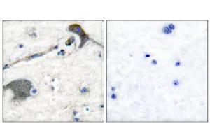 Immunohistochemical analysis of paraffin-embedded human brain tissue, using RASH/RASK/RASN antibody (ABIN5976497). (RASH/RASK/RASN (N-Term) Antikörper)