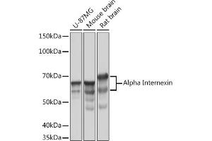 Western blot analysis of extracts of various cell lines, using Alpha Internexin Rabbit mAb (ABIN7268012) at 1:1000 dilution. (INA Antikörper)