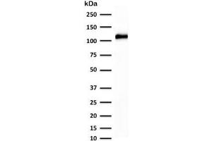 Western blot testing of human kidney lysate with recombinant Cadherin 16 antibody (clone KSCP2-2R).