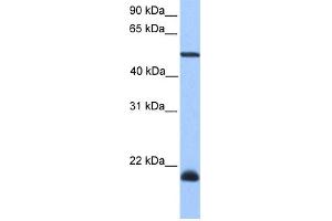 WB Suggested Anti-DYX1C1 Antibody Titration: 0. (DYX1C1 Antikörper  (C-Term))