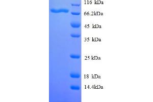 SDS-PAGE (SDS) image for Vitellogenin 2 (AA 26-653) protein (His tag) (ABIN5713018) (Vitellogenin 2 (AA 26-653) protein (His tag))