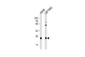 Western blot analysis of lysates from A549,U-87 MG cell line (from left to right),using CATL1 Antibody (heavy chain, Cleaved-Thr288)(ABIN6241621). (CPT1C Antikörper  (Cleaved-Thr288))