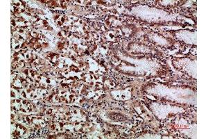 Immunohistochemical analysis of paraffin-embedded human-stomach, antibody was diluted at 1:200 (c-Rel Antikörper  (AA 491-540))