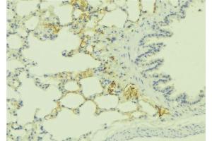 ABIN6275985 at 1/100 staining Human lung tissue by IHC-P. (Endothelin-1 Receptor Antikörper  (C-Term))