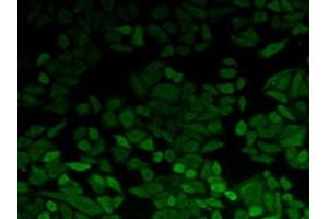 Immunohistochemistry (IHC) image for anti-Phosphoglycerate Kinase 1 (PGK1) (AA 2-417) antibody (ABIN7436240)