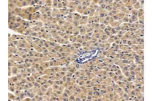 ABIN7094050 and ABIN7098094 at 1/100 staining rat liver tissue by IHC-P.