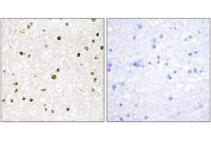 Immunohistochemistry analysis of paraffin-embedded human brain tissue, using AKAP11 Antibody. (AKAP11 Antikörper  (AA 1761-1810))