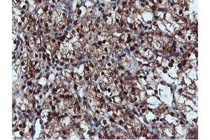 Image no. 5 for anti-Dual Specificity Phosphatase 23 (DUSP23) antibody (ABIN1497930) (DUSP23 Antikörper)