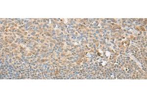 Immunohistochemistry of paraffin-embedded Human tonsil tissue using PSMD12 Polyclonal Antibody at dilution of 1:40(x200)
