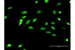 Immunofluorescence of monoclonal antibody to ZIC4 on HeLa cell. (ZIC4 Antikörper  (AA 1-90))