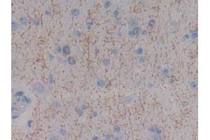 Detection of MBP in Human Cerebrum Tissue using Polyclonal Antibody to Myelin Basic Protein (MBP)