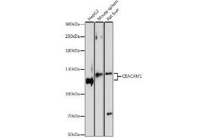 Western blot analysis of extracts of various cell lines, using CEACAM1 antibody. (CEACAM1 Antikörper)