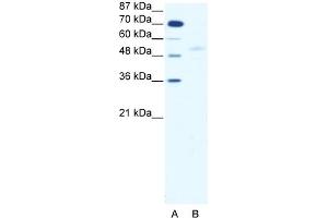 WB Suggested Anti-SMAD5 Antibody   Titration: 2. (SMAD5 Antikörper  (Middle Region))