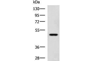 Western blot analysis of TM4 cell lysate using SNIP1 Polyclonal Antibody at dilution of 1:1150 (SNIP1 Antikörper)