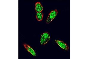 Confocal immunofluorescent analysis of SRC Antibody (N-term) (ABIN392107 and ABIN2841859) with  cell followed by Alexa Fluor 488-conjugated goat anti-rabbit lgG (green). (Src Antikörper  (N-Term))