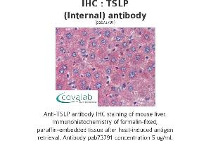 Image no. 1 for anti-Thymic Stromal Lymphopoietin (TSLP) (Internal Region) antibody (ABIN1740423)