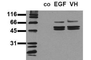 Western Blotting (WB) image for anti-SHC (Src Homology 2 Domain Containing) Transforming Protein 1 (SHC1) (pTyr239), (pTyr240) antibody (ABIN126888) (SHC1 Antikörper  (pTyr239, pTyr240))