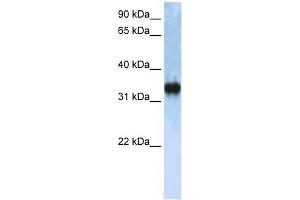 ZCCHC17 antibody used at 1 ug/ml to detect target protein. (ZCCHC17 Antikörper  (C-Term))