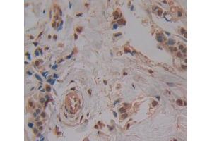 Used in DAB staining on fromalin fixed paraffin- embedded breast cancer tissue (DTYMK Antikörper  (AA 43-190))
