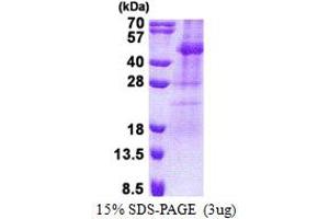 SDS-PAGE (SDS) image for Testis-Specific serine Kinase 2 (TSSK2) (AA 1-358) protein (His tag) (ABIN6387277) (TSSK2 Protein (AA 1-358) (His tag))