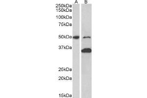 ABIN2563878 (1µg/ml) staining of Mouse fetal (A) and adult (B) Brain lysates (35µg protein in RIPA buffer). (MKRN1 Antikörper  (AA 105-118))