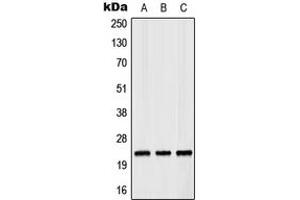 Western blot analysis of RAB35 expression in MCF7 (A), Raw264. (RAB35 Antikörper  (Center))