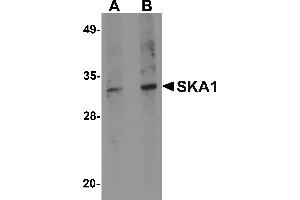Western blot analysis of SKA1 in A549 cell lysate with SKA1 antibody at (A) 0. (SKA1 Antikörper  (C-Term))