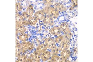 Immunohistochemistry of paraffin-embedded rat kidney using HPD antibody at dilution of 1:100 (x40 lens). (HPD Antikörper)
