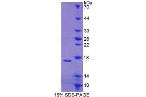 SDS-PAGE analysis of Human CABP1 Protein. (CABP1 Protein)