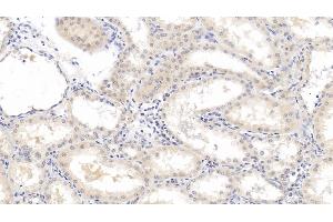 Detection of b2M in Human Kidney Tissue using Monoclonal Antibody to Beta-2-Microglobulin (b2M) (beta-2 Microglobulin Antikörper  (AA 22-119))
