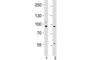 Western blot testing of UHRF1 antibody at 1:4000 dilution; Lane 1: KG-1 lysate, 2: MCF-7 lysate; Predicted molecular weight ~ 88 kDa.