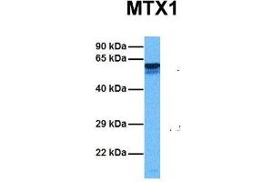 Host:  Rabbit  Target Name:  MTX1  Sample Tissue:  Human Ovary Tumor  Antibody Dilution:  1.