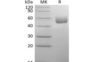 Western Blotting (WB) image for serpin Peptidase Inhibitor, Clade A (Alpha-1 Antiproteinase, Antitrypsin), Member 1 (SERPINA1) protein (His tag) (ABIN7320855)