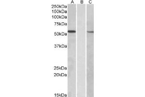 HEK293 lysate (10ug protein in RIPA buffer) overexpressing Human MGAT1 with C-terminal MYC tag probed with ABIN2563857 (1ug/ml) in Lane A and probed with anti-MYC Tag (1/1000) in lane C.