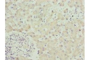 Immunohistochemistry of paraffin-embedded human liver tissue using ABIN7169619 at dilution of 1:100 (SPCS3 Antikörper  (AA 33-180))