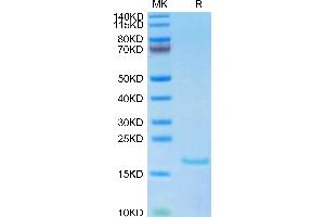Human IL-10 on Tris-Bis PAGE under reduced condition. (IL-10 Protein (AA 19-178))
