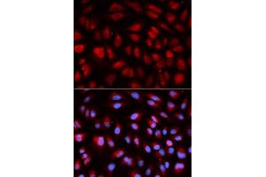 Immunofluorescence analysis of U2OS cells using PLK1 antibody. (PLK1 Antikörper  (AA 304-603))