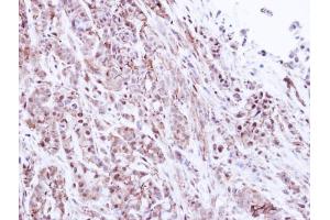 IHC-P Image Immunohistochemical analysis of paraffin-embedded A549 Xenograft, using 20S Proteasome alpha1, antibody at 1:500 dilution. (Proteasome 20S alpha 1 (Center) Antikörper)