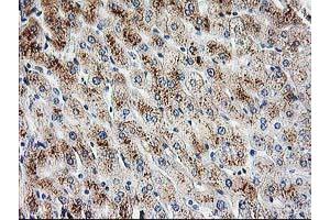 Immunohistochemical staining of paraffin-embedded Human liver tissue using anti-PBX1 mouse monoclonal antibody. (PBX1 Antikörper)