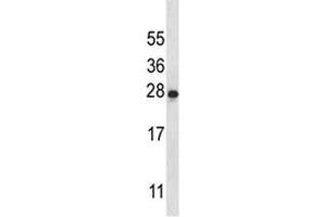 IL-22 antibody western blot analysis in K562 lysate
