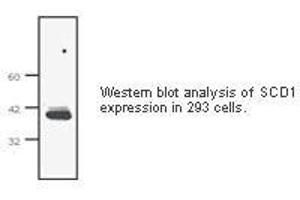 Image no. 1 for anti-Stearoyl-CoA Desaturase (Delta-9-Desaturase) (SCD) antibody (ABIN207646) (SCD Antikörper)