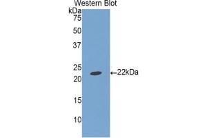 Detection of Recombinant IGFBP1, Porcine using Polyclonal Antibody to Insulin Like Growth Factor Binding Protein 1 (IGFBP1) (IGFBPI Antikörper  (AA 112-262))